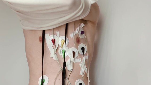 young thin man takes off shirt on white background. holter monitor is connected to his chest underneath. wires are attached to skin with patch. recording electrical cardiogram of heart for 24 hours