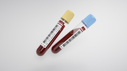 Obraz premium Watertight containers with blood samples.