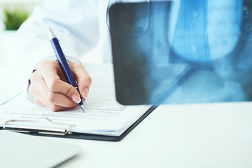 Close up of female doctor holding x-ray or roentgen image and making notes in medical form.