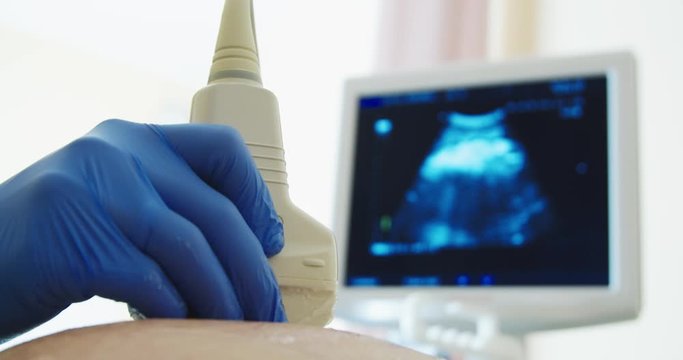 Close-Up obstetric Ultrasound scans. Ultrasound investigation of a pregnant woman. Pregnant belly in the foreground