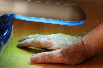 Phototherapy for skin diseases. Treatment of skin diseases such as Vitiligo, Psoriasis, and Eczema with narrow-band ultraviolet B.