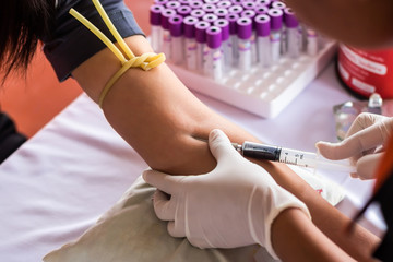 The doctor uses a needle to draw blood. Taken to check for congenital disease and take the blood to the lab to find the cause of various diseases in the human body.