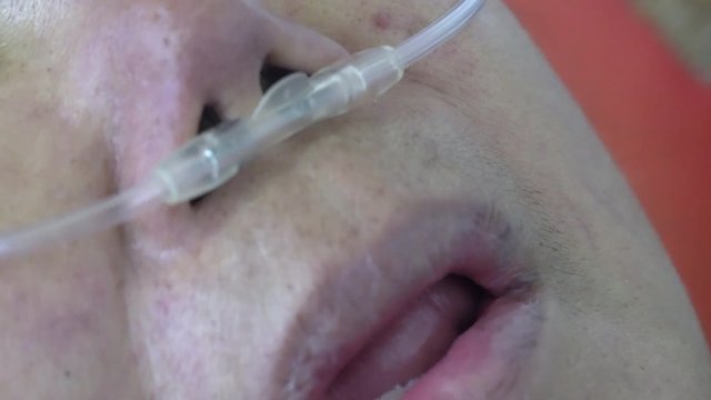 Elderly woman with nasal breathing tube to help with her breathing at home