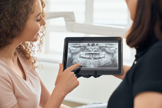Selective focus of x ray picture of teeth on tablet