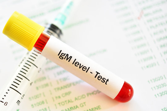 Blood sample tube for Immunoglobulin M or IgM level test, diagnosis for immunodeficiency disease