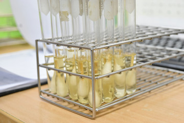 laboratory microbiology bacteria agar tube in incubator quality control process in factory.