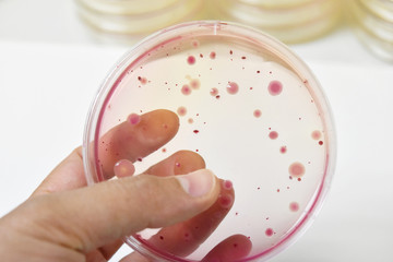 Colonies of bacteria growth on agar plate medium in microbiology laboratory. 