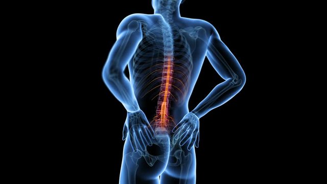 Human back pain, animation.