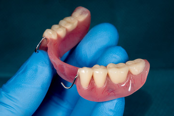 denture. Partial removable denture of the lower jaw of a person with white beautiful teeth in the hand of a dentist. Aesthetic Dentistry
