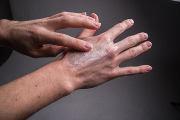 Fototapeta premium apply sunscreen on the hands