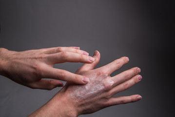 Fototapeta premium apply sunscreen on the hands