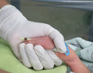 Nurse´s hand with gloves making blood test by venipuncture from newborn baby patient at the...