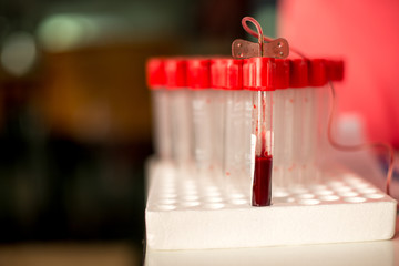 Draw blood,blood collecting from a patient , Laboratory
