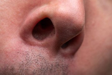 Image of young man with open nose