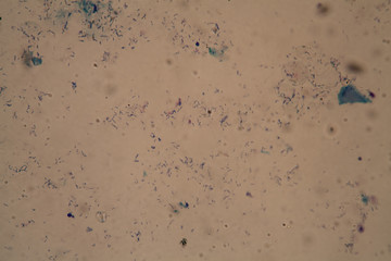 Tuberkulose Bakterien unter dem Mikroskop 400x