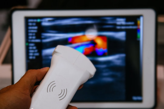 Modern portable ultrasound machine in clinic laboratory of sonography diagnostics