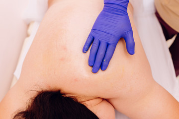 Hands of therapist performing massage on young caucasian woman. Chinese traditional massage - Gua Sha, body care and wellness