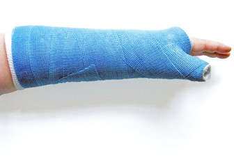 Broken wrist in cast, isolated on white