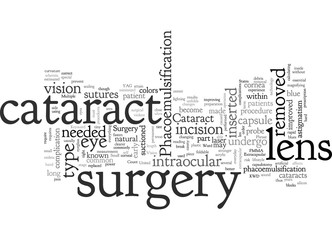cataract surgery