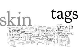 A Guide on Skin Tags