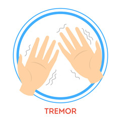 Parkinson disease symptoms. A tremor. Shaking hand