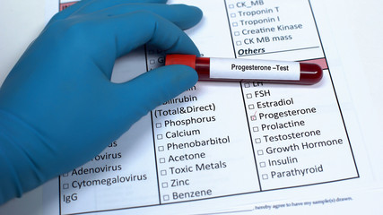 Progesterone, doctor showing blood sample in tube, lab research, health checkup