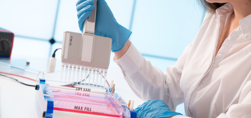 Loading Samples and Running an Agarose Gel for electrophoresis, Gel electrophoresis is the standard lab procedure for separating DNA