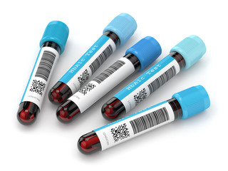 3d render of HbA1c blood tubes over white - obrazy, fototapety, plakaty