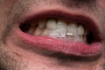 Image of young man, showing teeth, close up