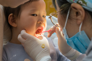 Viewed oral hygiene. Child to the dentist. Child in the dental chair dental treatment during surgery.