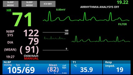 Medical vital signs monitor, cardio sensor patient health condition diagnostic