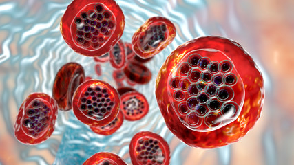 The malaria-infected red blood cells. 3D illustration showing parasite Plasmodium falciparum in schizont stage inside red blood cells, the causative agent of tropical malaria