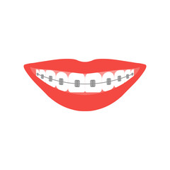 Beautiful smile with aesthetic braces