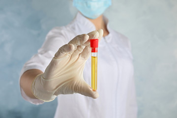 Doctor holding test tube with urine sample for analysis on light blue background, closeup