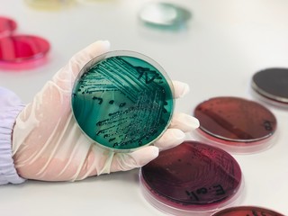 Thiosulfate-citrate-bile salts-sucrose agar, or TCBS Agar green media in Petri dish, selective agar culture plate used in microbiology laboratories to isolate Vibrio species. Handle in scientist hand.