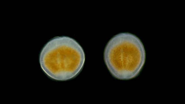 A larva, an embryo under a microscope, planus Coelenterata, Radiata, after a period of swimming, the planula settles to the bottom and develops into a polyp, or a jellyfish. Zooplankton and plankton o