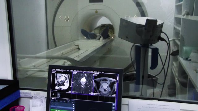 Patient inside a CT scan machine. Medical facility tests