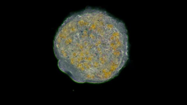 A larva, an embryo under a microscope, planus Coelenterata, Radiata, after a period of swimming, the planula settles to the bottom and develops into a polyp, or a jellyfish. It has a mouth opening and