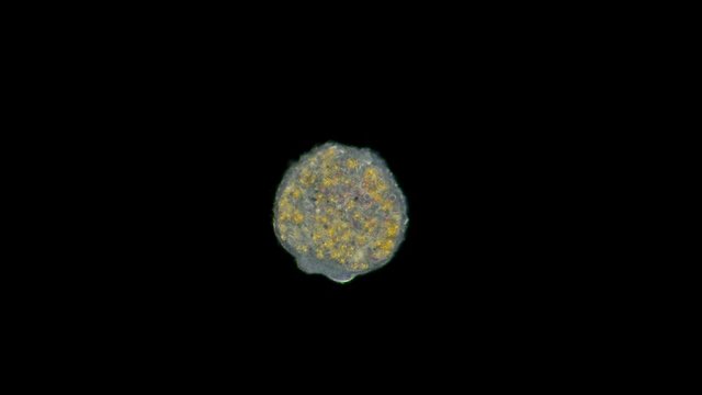 A larva, an embryo under a microscope, planus Coelenterata, Radiata, after a period of swimming, the planula settles to the bottom and develops into a polyp, or a jellyfish. It has a mouth opening and