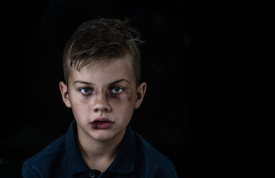 Portrait of the boy victim of domestic violence and abuse. Isolated on dark background. Empty space for text