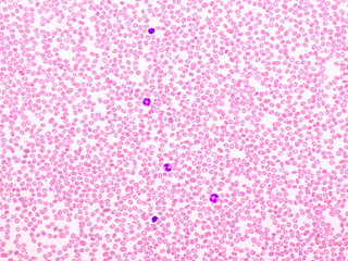 Picture of white blood cell, red blood cell and platelet in blood film, analyze by microscope, 400x 