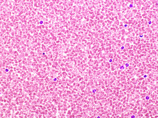 Picture of white blood cell, red blood cell and platelet in blood film, analyze by microscope, 400x 