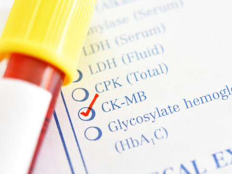 Blood sample tube for CK-MB test, diagnosis for heart attack