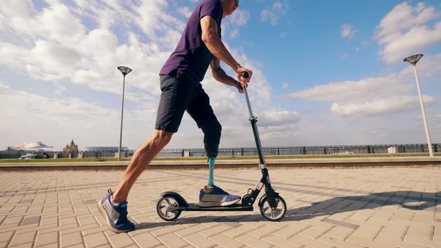 Scooter is being handled by a man with a bionic leg