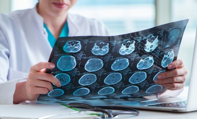 Doctor examining MRI image in hospital - obrazy, fototapety, plakaty