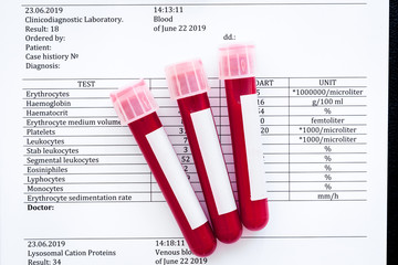 Blood tubes on test results top view