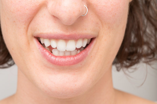 Details of a girl's teeth. Conceptual image of bruxism, symptom of teeth grinding during sleep
