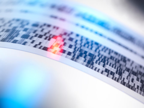 Autoradiogram showing DNA results during genetic testing