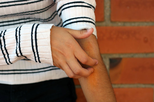 Young women scratch the itch with hand
