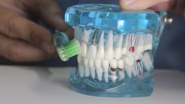 Escova&ccedil;&atilde;o com Molde de Dentista